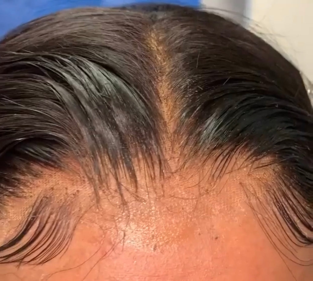 “HD” 5x5 Closure