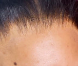 “HD” 5x5 Closure